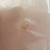 吓死了 今天白带里面带血丝了 明天早上去医院检查