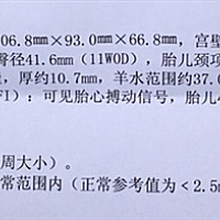 做了NT，可以看出男女宝宝吗😄