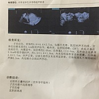 亲们帮忙看看，不是宫外孕吧