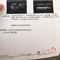 大家帮我看看是男宝还是女宝呢？纯粹好奇，头胎儿女都喜欢，八周时拍的B超