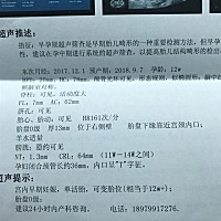 有谁会看男女吗？