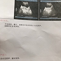 末次月经1月13日 今天来医院检查的求大神给看看