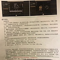 27周了，有没有看得懂的，男宝还是女宝