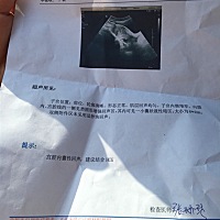 请问这是怀孕了吗