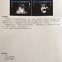 今天45天左右，去做了B超，有了胎心胎芽，悬着的心终于放下了！但是出现了新的情况，之前从未有过的囊肿...