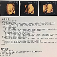 大家都来猜猜男宝女宝