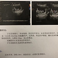 5周开始干呕没胃口，慢慢发展到偶尔吐，到八周开始吐得很历害，喝水也吐。现在十周了，最近是吃啥吐啥，...