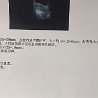 我想知道宝宝是几天了