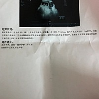 男孩还是女孩啊？