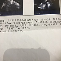 各位宝妈。帮忙看看是男孩还是女孩
