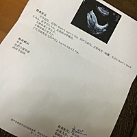 亲爱的宝妈们，今天做了这个检查，第一次，有经验帮我看下，谢谢哈