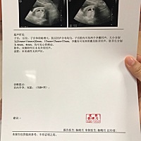 孕酮这么低 我该注意些什么？还有各位亲 宝宝6周我该补些什么，谢谢啦。
