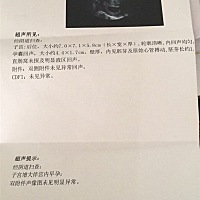 进来帮忙看下男女！