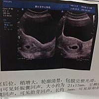 大家好，帮忙看下男宝还是女宝呢。谢谢🙏