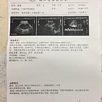 30周做的多普勒彩超，希望是健康男宝，大宝是女儿