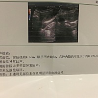 最后一次月经来是1月12日，我月经一直很准时的，这个月没来，验孕棒显示是阳性不过很浅，2月23日去查了b...