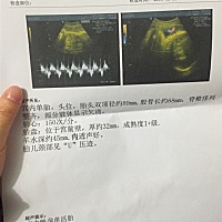 想问一下如果自己有奶水还用不用准备奶粉的啊？要的话初生婴儿吃哪个牌子的奶粉比较好啊？