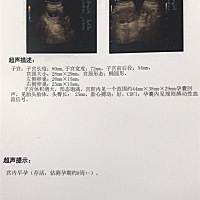 哪位妈妈可以看出男孩女孩？跪求！！已经有个儿子了，婆家怕再生个男孩，现在逼我打掉这个孩子，可是，...