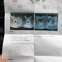 有没有哪位姐妹会看的？为啥还不见胚芽组织和原始心管搏动呀？