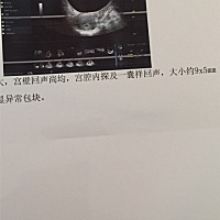 孕妈们帮我看看是男是女呀，谢谢大家了🙏🏽