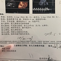 25周检查四维，大长腿，随我😂