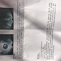 怀孕五十多天，来猜一猜是男孩还是女孩？娱乐一下