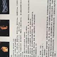 好奇男女，有懂的吗？