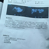 有患过宫外孕的亲吗，真的好绝望啊，我的孩子就这么没了😭