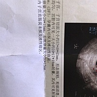 第一次怀孕，今天检查的结果，搏动性流血有人知道是什么意思吗