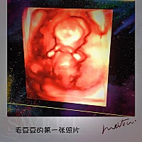 怀孕12周多一点，好想知道是男孩女孩，不知道这里有哪位经验丰富的大神可以帮我看看吗？感激不尽