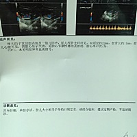 想问一下三个月左右 四腔心显示欠清正常吗😭