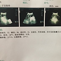 求大神帮看男女，孕8周
