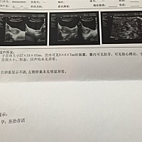 今天做了B超，中于放下心了，不在乎是男宝宝还是女宝宝，只要宝宝健健康康就好，接好孕😻