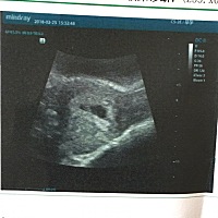 末次月经1月9号，今天彩超了，看见了胎心胎芽，医生说长得不错，就是孕酮偏低，让多喝豆浆！期间无异常...