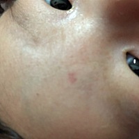 这个点能不能消失