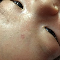 这个点能不能消失