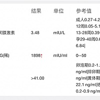 报告一周后打印才可以咨询医生，这个有懂什么意思的吗