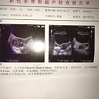 42天的彩超 谁可以看的懂 我宝宝的位置在哪里吗？
