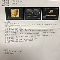 24周，各位宝妈会看是男宝还是女宝吗？