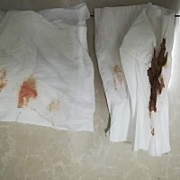 今天怀孕第35天，昨天晚上近10点身上流了粉红色，半夜1:30流的黑紫色（近似开完例假的那种），现在暂时...