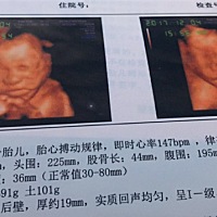 预产期倒计时开始❤️