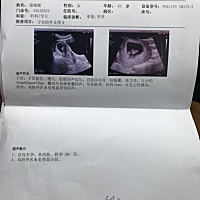 50天的B超，有哪位高手能看出男女吗😄