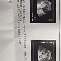 这个结果是正常么？可以看出男女么？