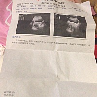 这个是怀孕有多少天了，应该是说受精多少天了