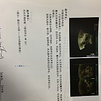 有经验的帮我看看男女