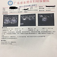 各位孕妈懂的帮我看看，这样正常吗？还没给医生看，之前试过疤痕妊娠清宫，比较担心，只愿不要长在刀疤...