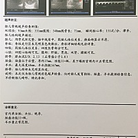 十五天前做了次B超虽然不写孕几周，但是有写胎儿重量。今天感觉做了次假B超，孕周重量都不写，特么担心！