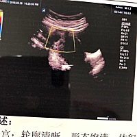 孕40天左右，只见点状胚胎组织，卵黄囊回声，未见原始心管搏动