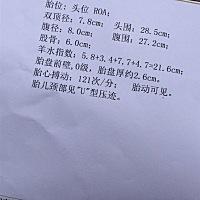 羊水多。29周6天的单子