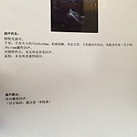 怀孕46天，还未见胎芽胎心